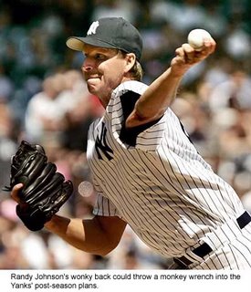 Randy Johnson, the Big Unit, is having back issues again.